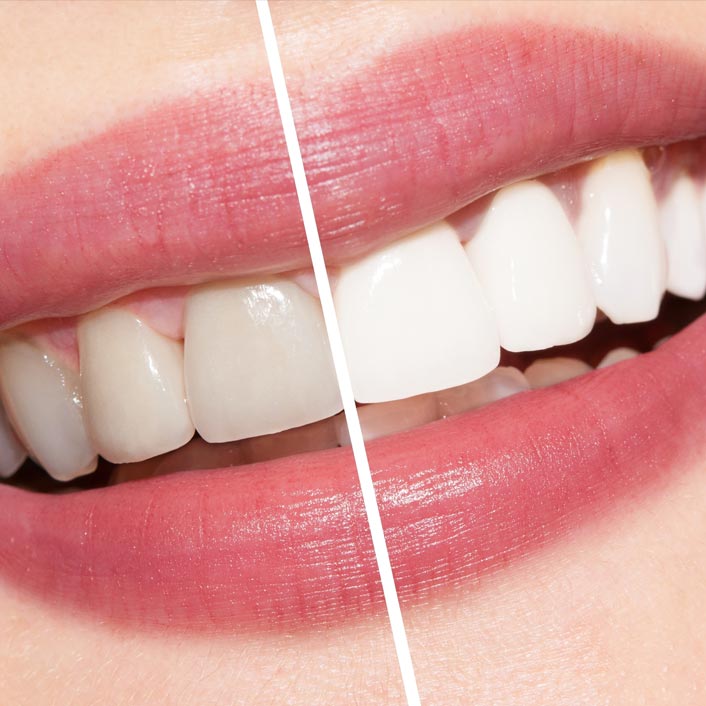 Cosmetic Dentistry