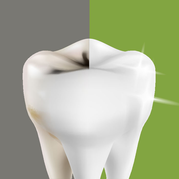 Restorative Dentistry