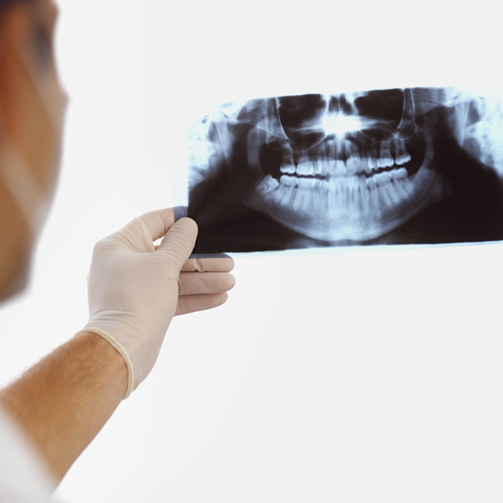 Traditional X-Ray - Dental Technology